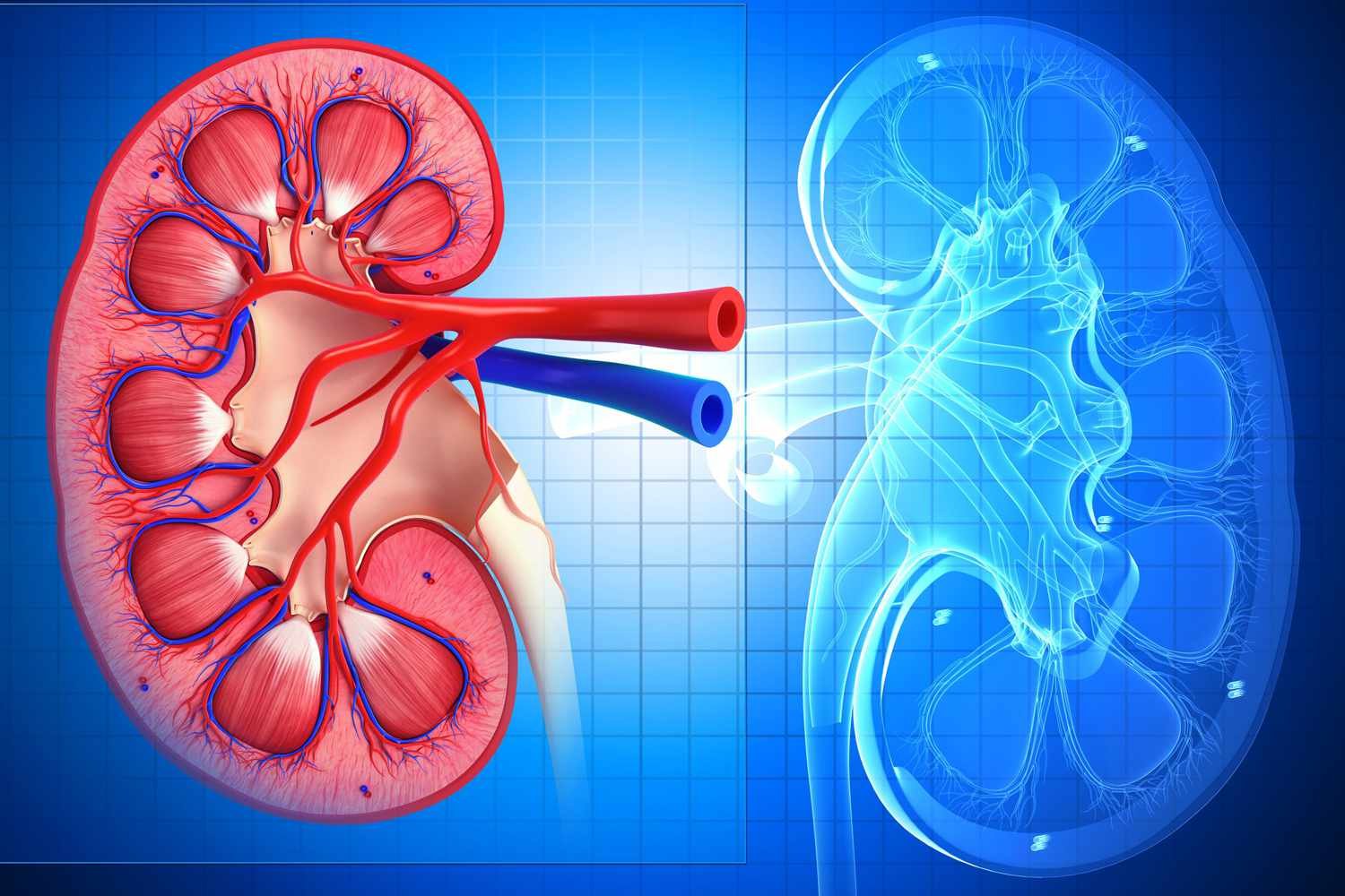 Acute Renal Failure