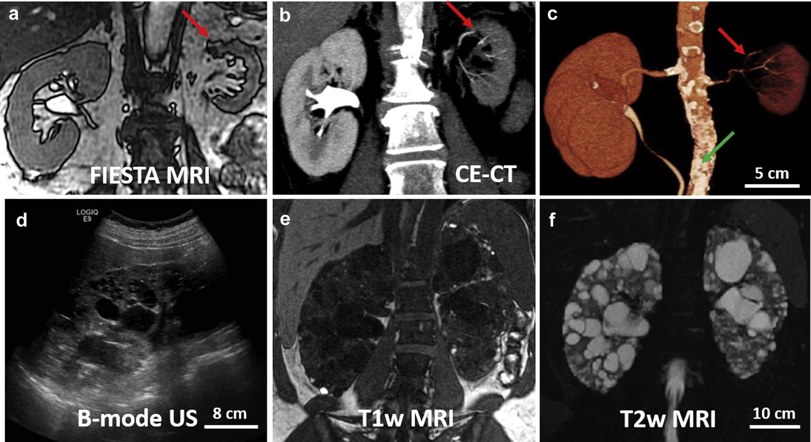 Renal Imaging