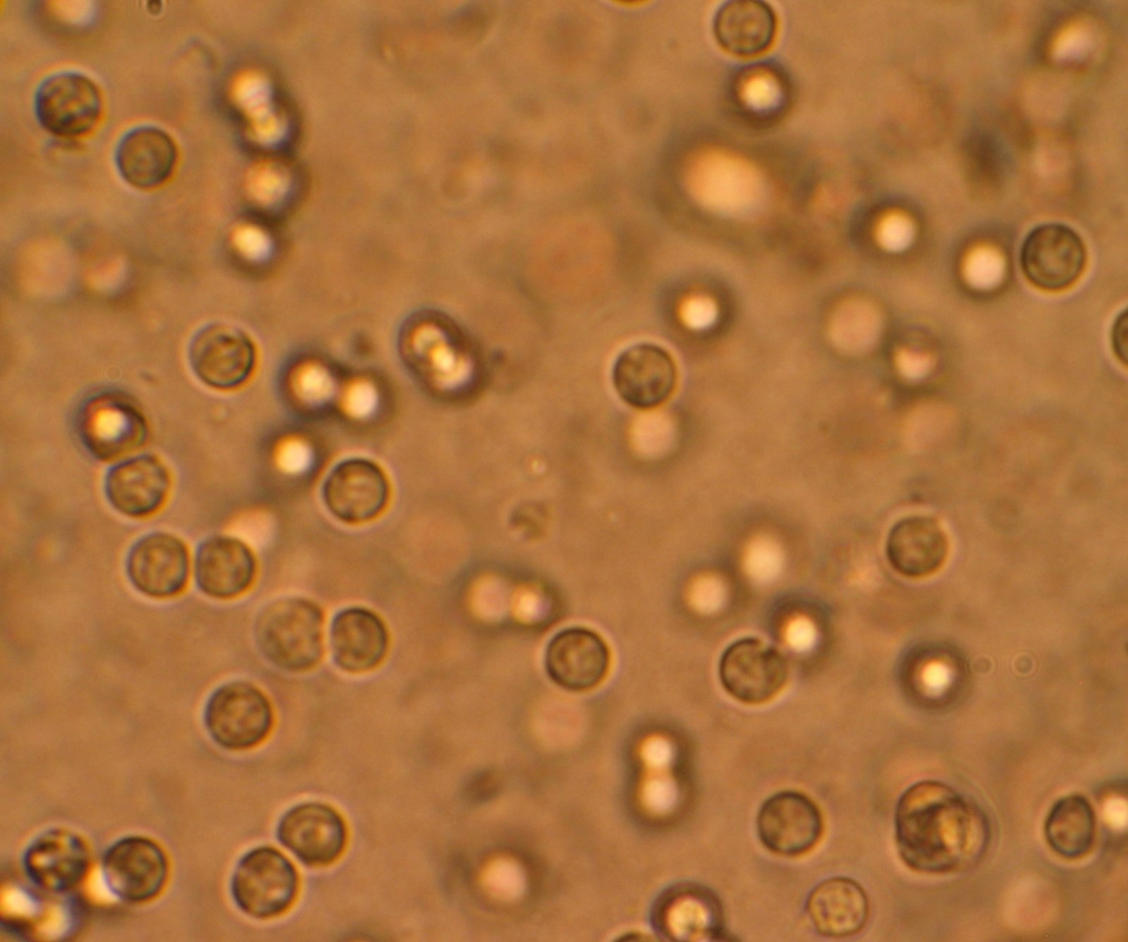 Urine infection