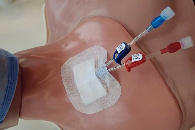 dialysis-cathetet-insertion