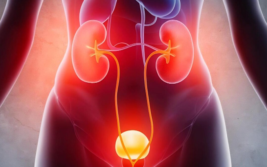 Urine Infection