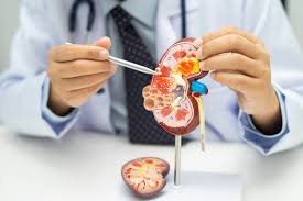 Kidney treatment in Nagpur