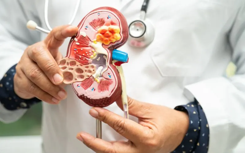 Top nephrologist near me