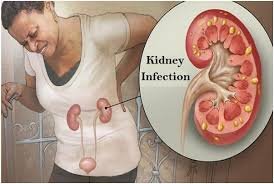 Treatment for kidney infection Nagpur